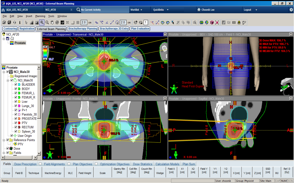 NCI computational phantom DICOM CT and RT Structure Set displayed in a treatment-planning system